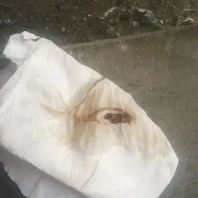 各位专家们我怀孕已有两个月了,刚上厕所下面流出褐色东西,不知是什麼