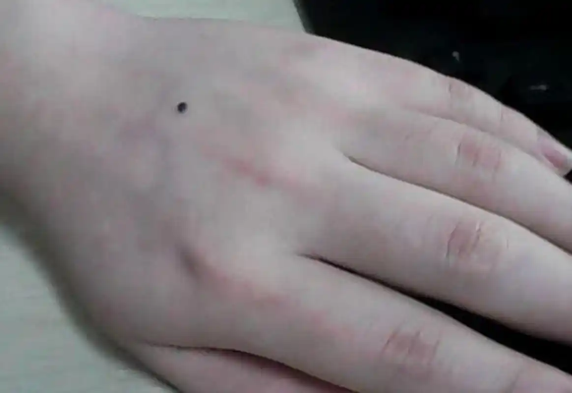 手背有痣的寓意 "手心主富,手背主贵",如果手背上有的痣是善痣,预示此