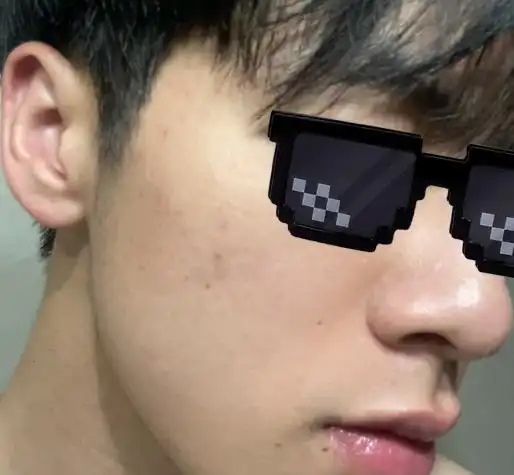 男生毛孔粗大皮肤很黑很粗糙怎么办