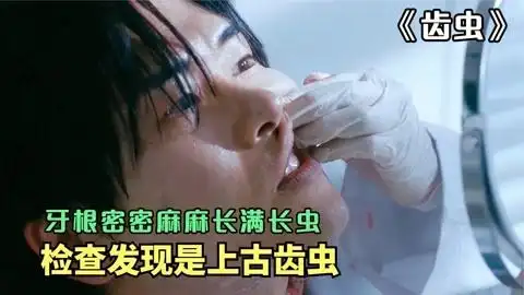 牙龈上满是蛆虫,检查后发现是上古齿虫,惊悚恐怖片