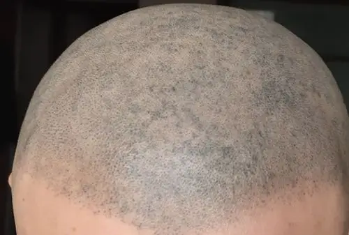 谈谈关于smp纹发失败案例的修复.