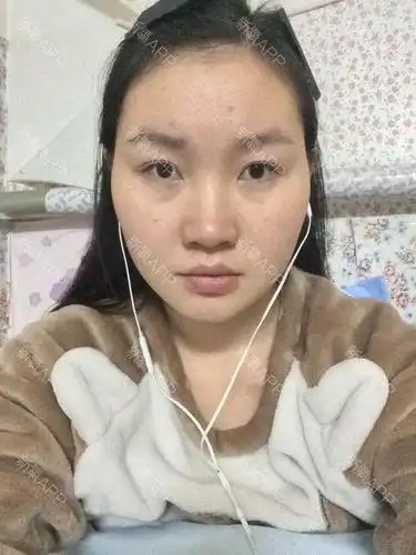 我这大饼脸应该怎么办阿?求各大神支招!