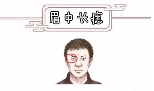 身上5颗靠山痣横财硬正财稳颗颗显贵儿女双全