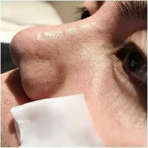 美容院做一次毛孔深层清洁几百块到底值不值?