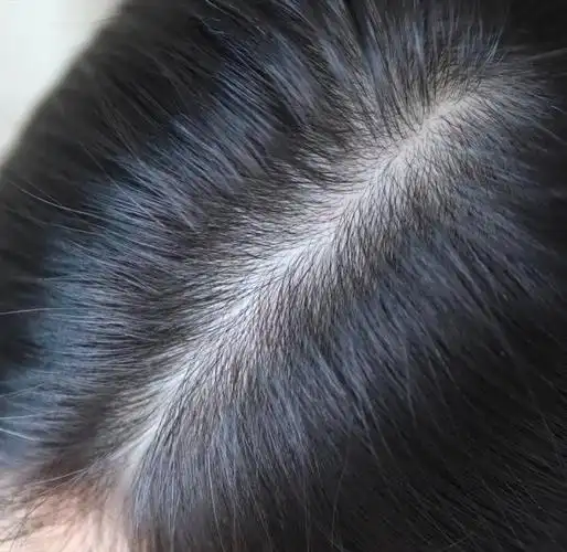 借你个显微镜看看老娘的头皮,找出点头皮屑算我输!