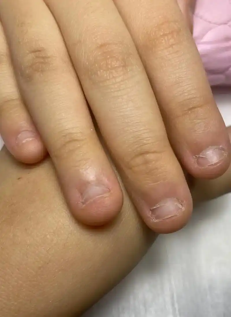 13岁啃咬甲小妹没变身过程.#短指甲也可以这么美 #啃指甲矫 - 抖音