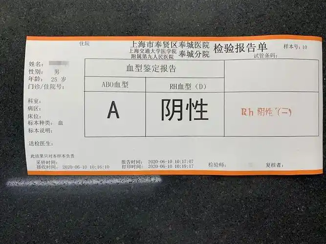 如果检测到rh阴性的患者所以rh血型鉴定也是需要十分关注的即可导致