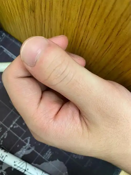 指甲短怎么回事