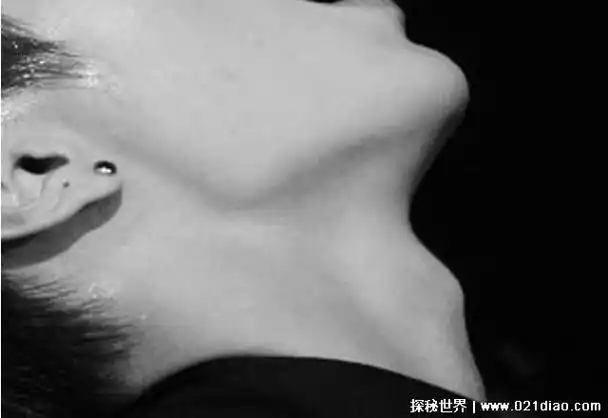 男生的喉结可以摸吗 男生的喉结为什么不能碰