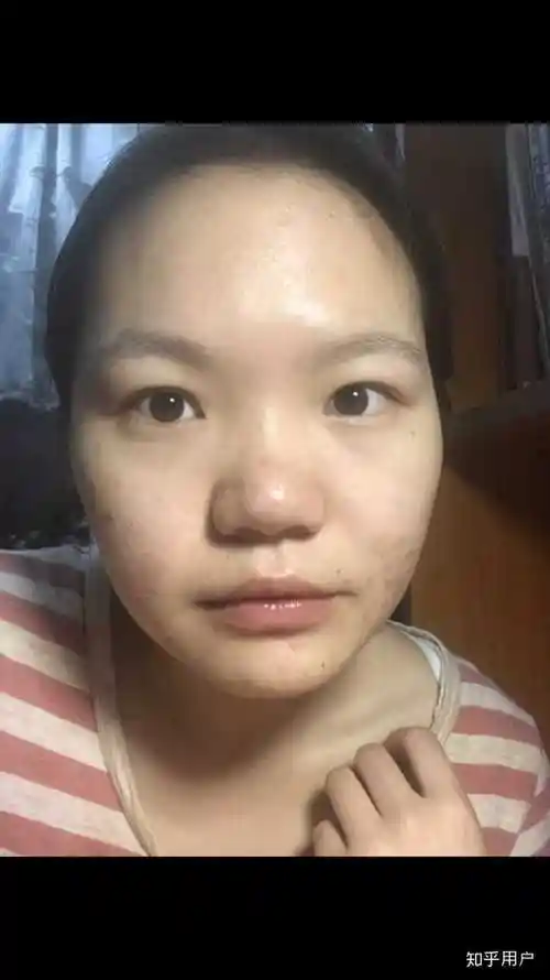 塌鼻子适合什么发型 塌鼻子做什么发型好看