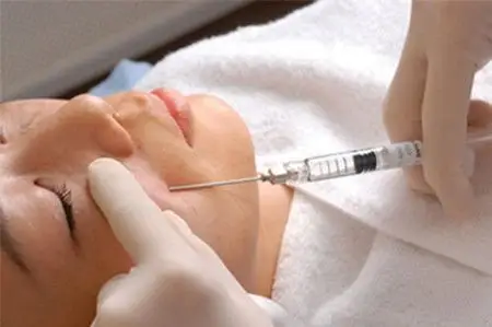 打玻尿酸有风险,整形需谨慎