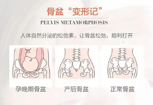 产后"骨盆"恢复很重要,产后妈妈们必须知道!