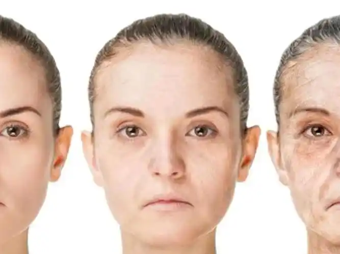 一张"垮脸"毁所有,简单来说就是岁月 地心引力的产物导致皮肤松弛下垂