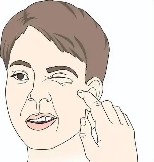 什么是面瘫:周主任:面神经炎俗称面神经麻痹(即面神经瘫痪),"歪嘴巴"