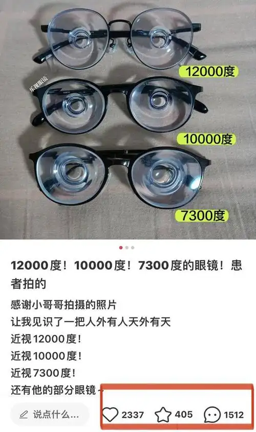 12000度近视眼引发热议专家这些要注意