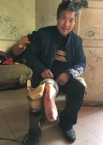 河南省伊川县鸦岭乡鸦岭村,有一对残疾夫妻,丈夫小腿截肢,妻子糖尿病
