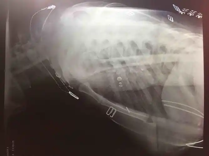 肩关节疼痛肩关节正侧位平片未见明显异常