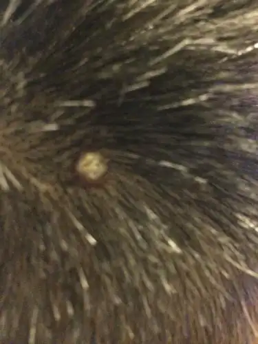 头皮上长了一个这样的东西有很厚的痂是什么?