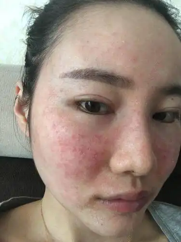 皮肤刺痒是怎么来的?