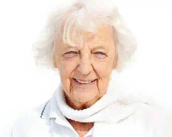 中年人与老年人皮肤屏障的特点