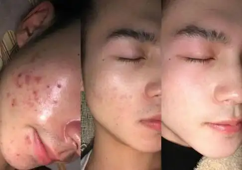 男士如何护肤有什么好的护肤品推荐