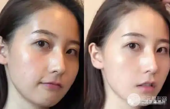 光子嫩肤 水光美肌:这才是夏季人人都需要的美白嫩肤的优解!