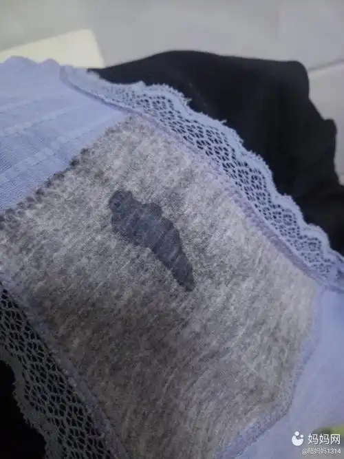 孕晚期,内裤老是有这些,正常吗,老是湿湿的,你们有 | 妈妈网轻聊_千万