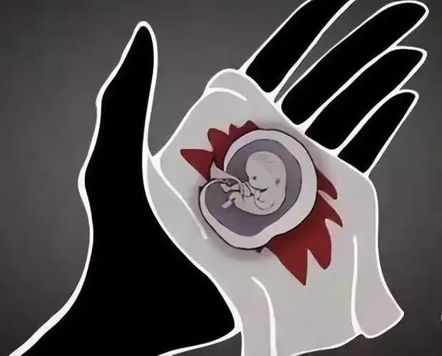 一个血淋淋的事实:人流每天都在发生