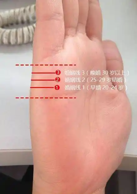 5,手掌有痣手掌的痣一般都是属吉痣,手掌心的痣代表智且富,代表你很