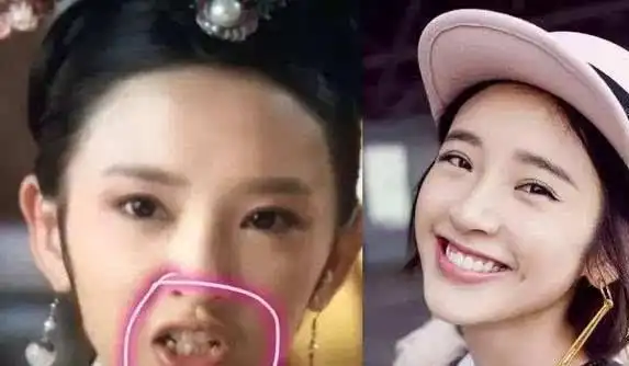 明星整牙堪比整容,看清对比图后,网友:妈妈,我被坑得好苦啊
