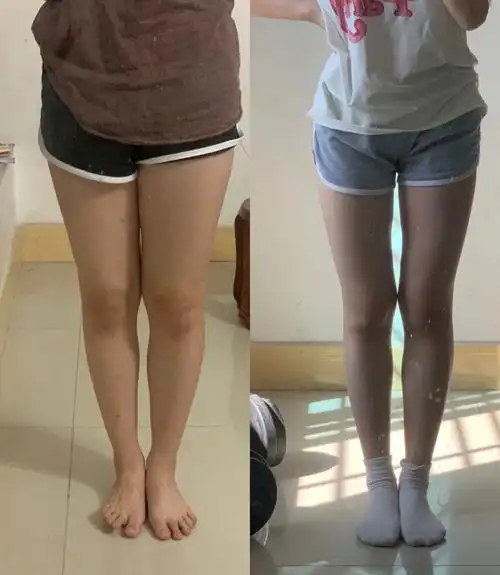 坚持改善假胯宽真的有用60大腿缝隙都明显了