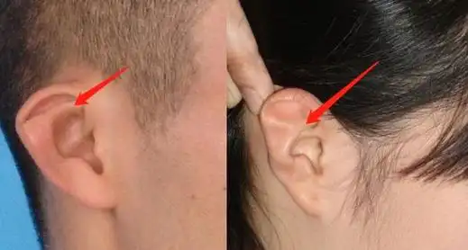 热巴最新直播自爆从小到大最自卑的颜值bug!竟然不是鼻子