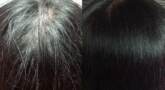 坚持用了一段时间,头顶露出来的白发少了头发也浓密了