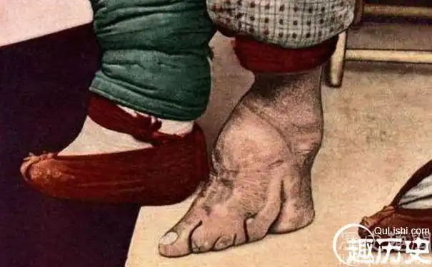 裹小脚的照片缠足一般都在妇女会走路以后才开始裹脚,在中国生下来