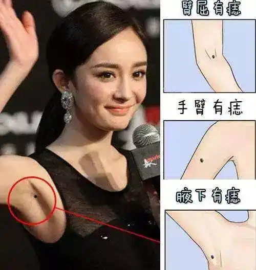 腋下有痣为搂宝!这些不常见的痣预示着什么?