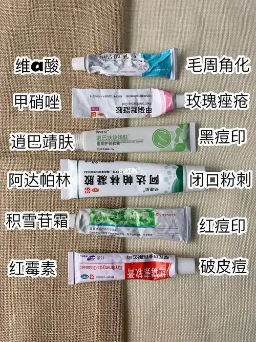 油痘肌必备的平价药膏女孩好皮肤常用