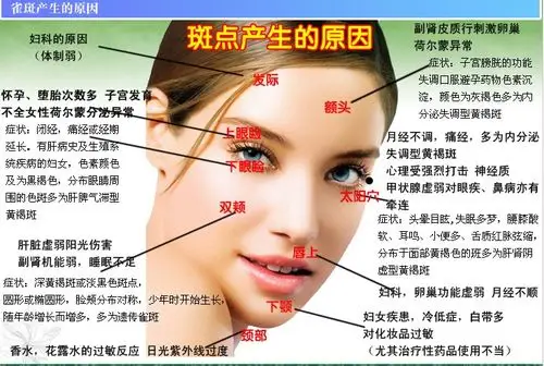 展开全部 这是无关的,有的雀斑是遗传的,雀斑是 不同部位的雀斑原因