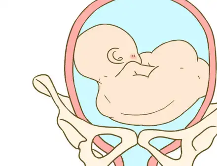 在正常情况下,胎儿的胎位一般都是头位的,但如果不是头位而出现了横位