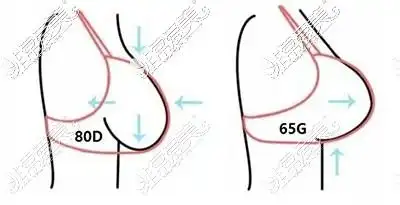 年轻人胸下垂的原因揭秘直白分析为什么年纪小就胸下垂