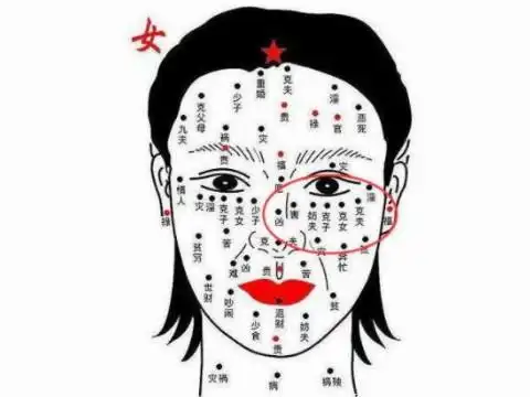 女人面部痣相图解痣的位置与命运