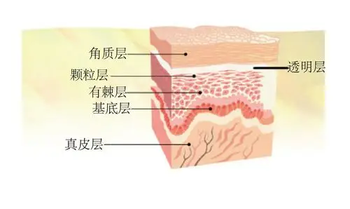 由外到内,分为角质细胞,颗粒层,有棘层,基底层.
