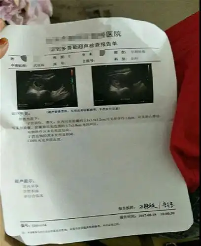 多囊艰辛的备孕历程,褐色分泌物后终于看到胎心