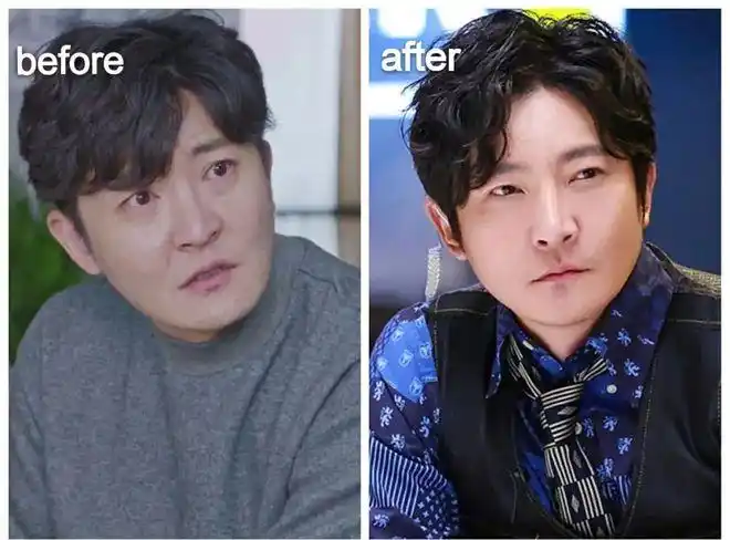 此外,马东,郭京飞割眼袋后,也是颜值飞升.