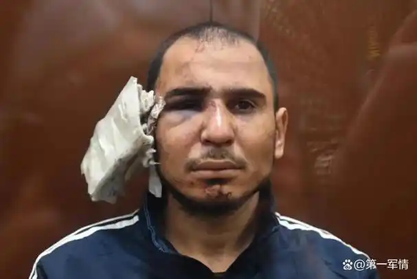 电击下体割耳朵爆眼球俄公布照片4名恐怖分子生不如死