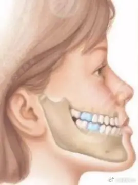 【96下巴越来越长有什么影响?】