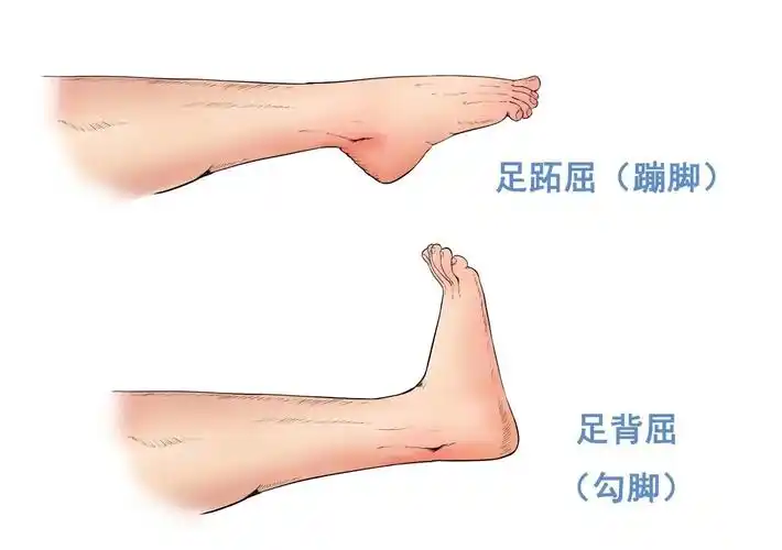 二,直腿抬高练习:患者平卧或坐姿,背屈(勾脚尖)绷紧腿部肌肉,缓慢直腿