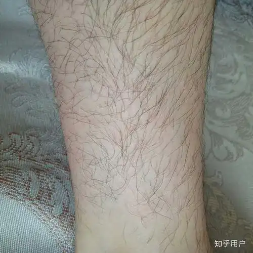 男生看到有腿毛的女生是什么感受?
