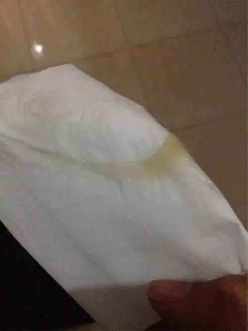 有图慎入,白带好吓人