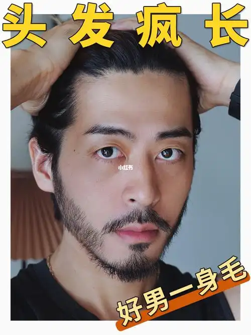 头发多到去打薄发缝宽头发稀的兄弟们来