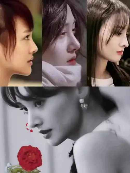 郑爽近照白到发光五官精致美回巅峰网友辣评假体取出来了